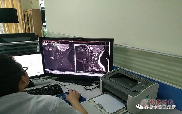 “睿顯”助力合川醫院“區域影像中心”