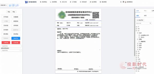 你點燃的不是煙，是生命--睿顯專業醫療顯示器助力精確診斷