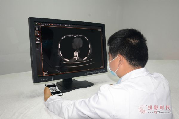 你點燃的不是煙，是生命--睿顯專業醫療顯示器助力精確診斷