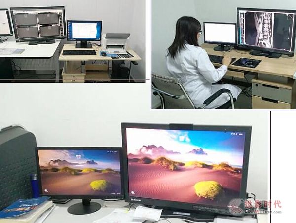 睿顯專業診斷顯示器入駐陽泉市醫院
